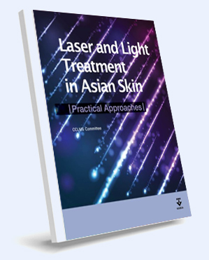 Laser and Light Treatment in Asian Skin